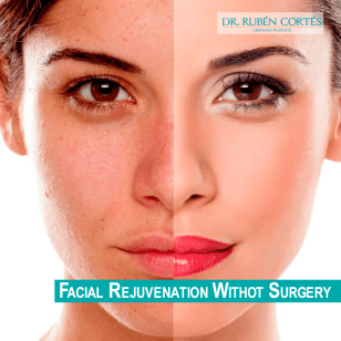 13-Rejuvenecimiento-facial-sin-cirugía-Dr-Cortes-ingles