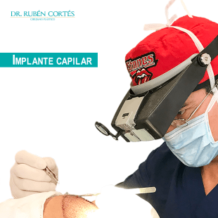 18-Implante-capilar--Dr-Cortes-web