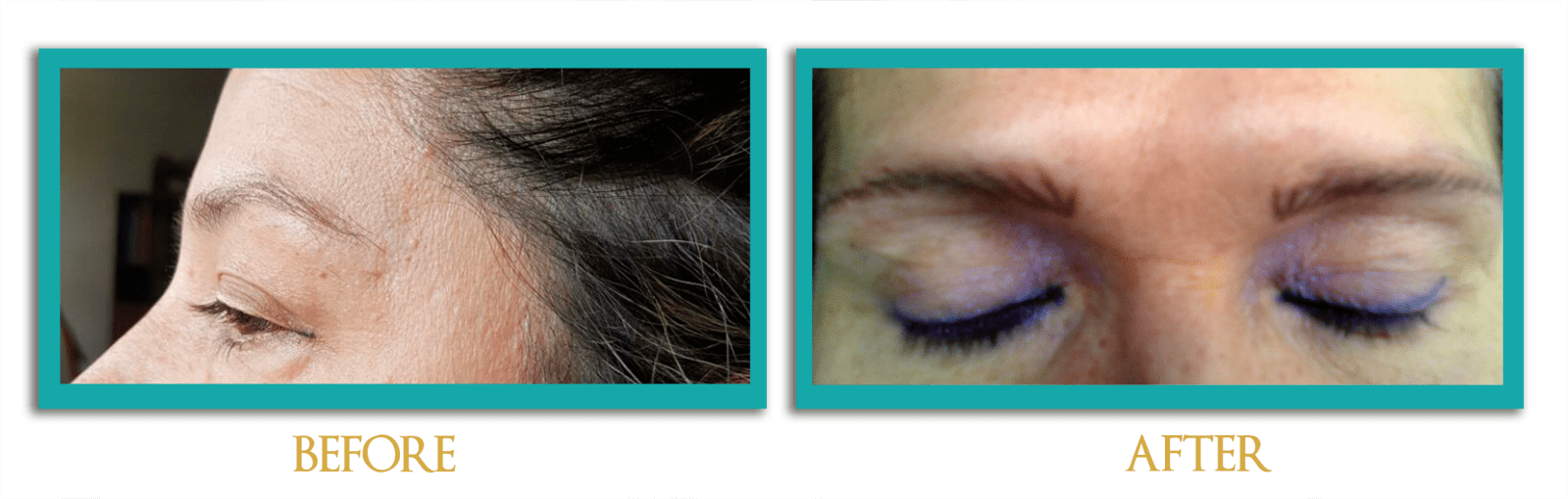 dermopigmentacion-4-ingles