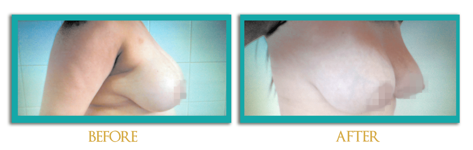 reduccion-mamas-ingles