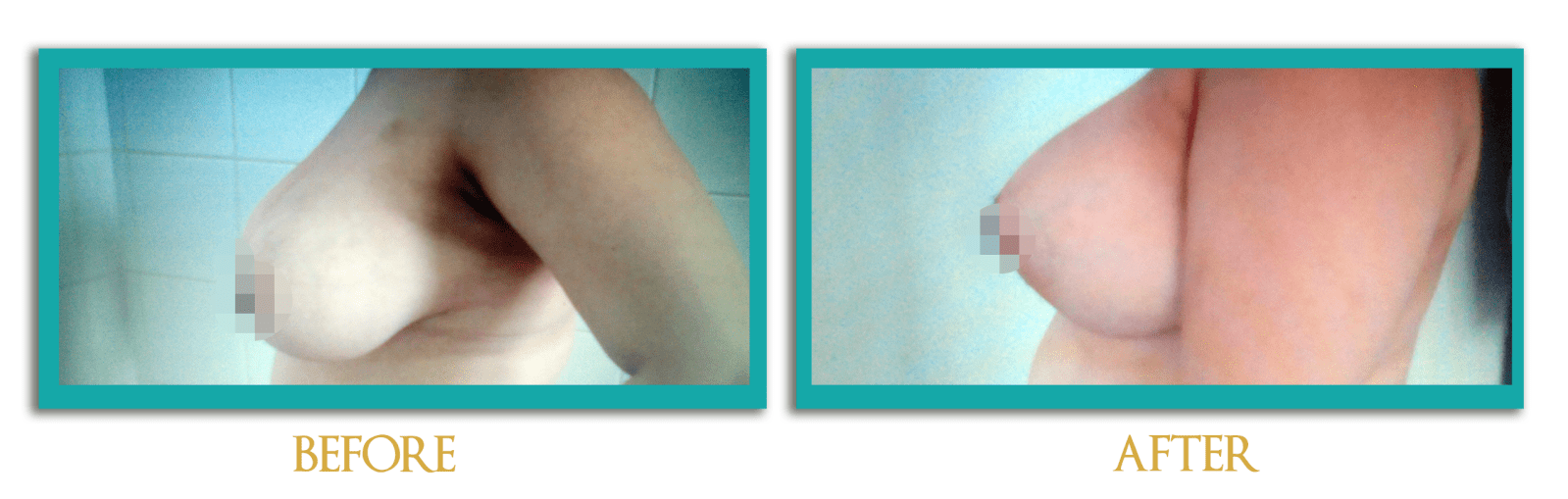 reduccion-mamas2-ingles