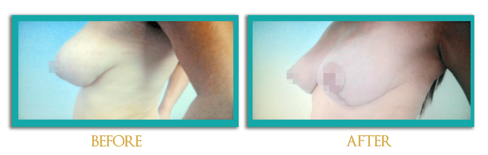 reduccion-mamas4-inlges