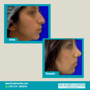 Antes-y-despues-Agosto-1-con-azul